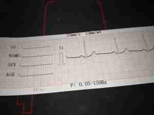 Lead II Example Printout